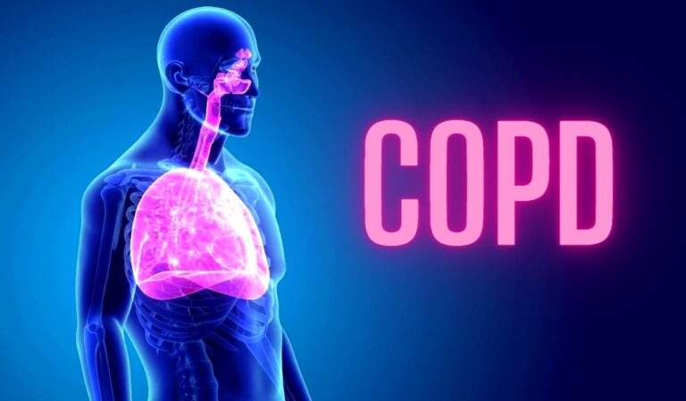 The Four Stages Of COPD Explained - A Detailed Overview